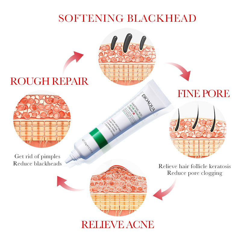 1/2/3pcs BIOAQUA Crema per il  - Salicylic Acid Blackhead Remover recensione e prezzo