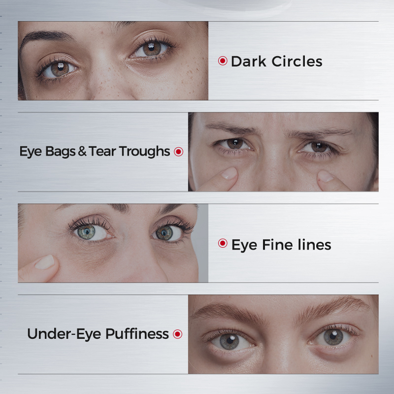 Patch per Occhi Contro Occhiai - Collagen Under Eye Patches recensione e prezzo