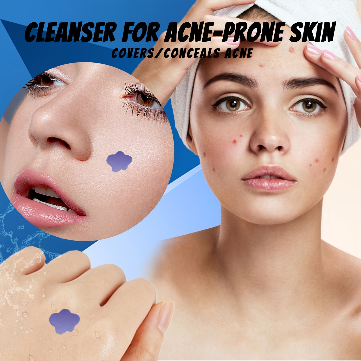 Cerotti Microneedle per Acne e - Skincare recensione e prezzo