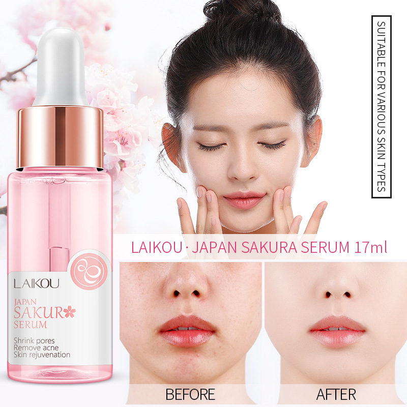 LAIKOU Sakura siero e collagen - Niacinamide Pore Shrinking Essence recensione e prezzo