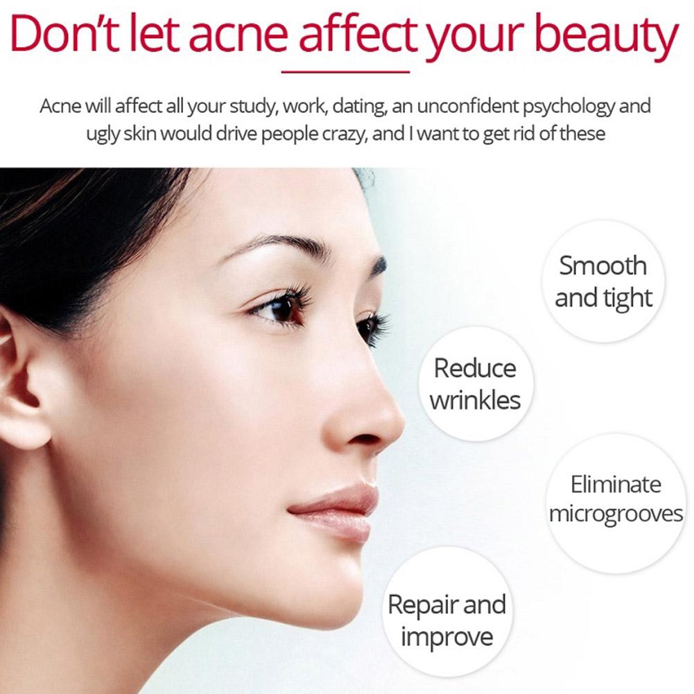 Crema rassodante Lifting al re - Retinol Anti Wrinkle Cream recensione e prezzo