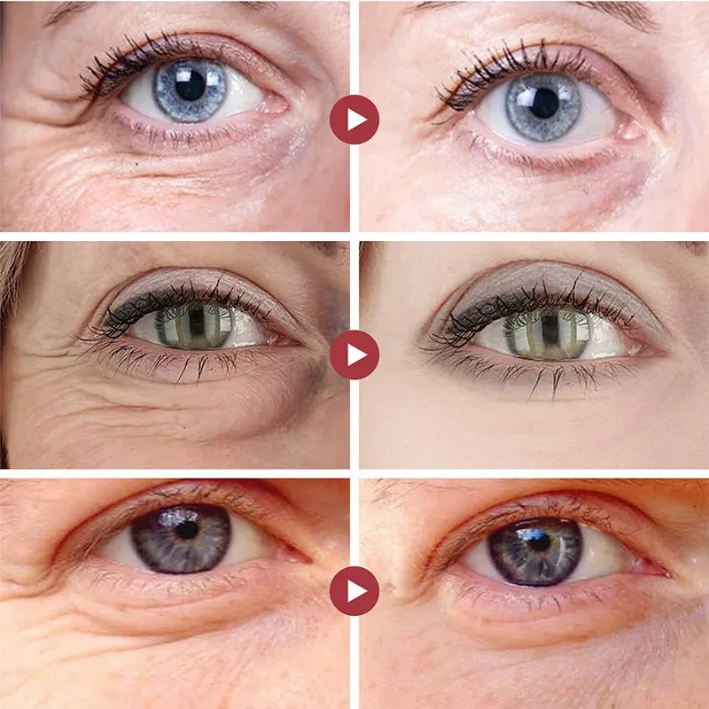 Rughe Rimuovere Gli Occhi Patc - Collagen Under Eye Patches recensione e prezzo