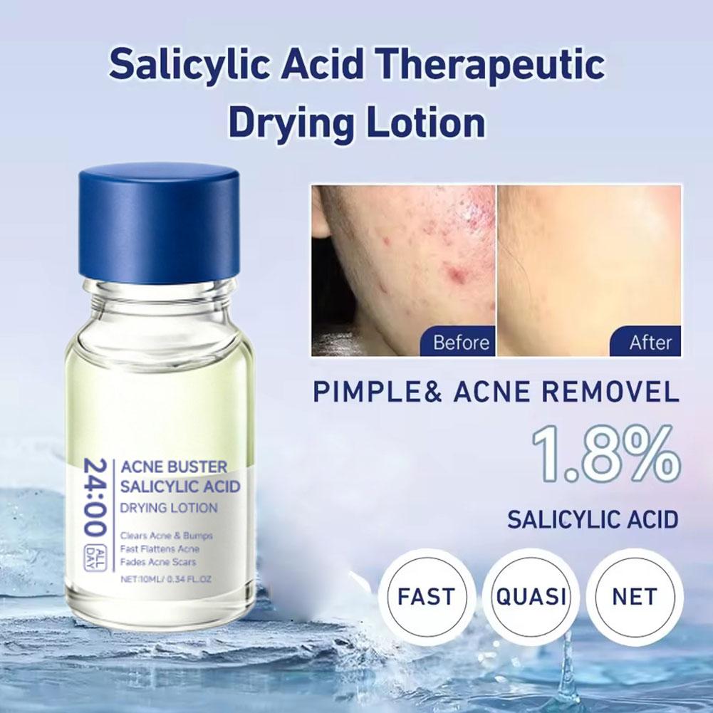 Acido Salicilico Rimuovi Acne, - Salicylic Acid Blackhead Remover recensione e prezzo
